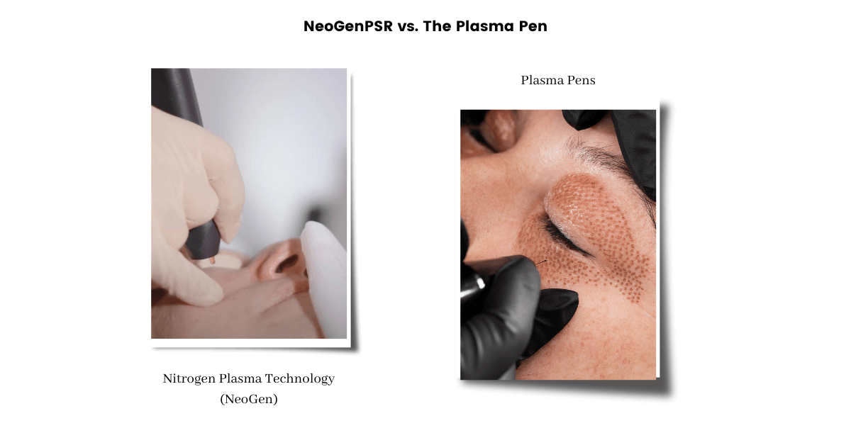 NeoGenPSR vs. Plasma Pens